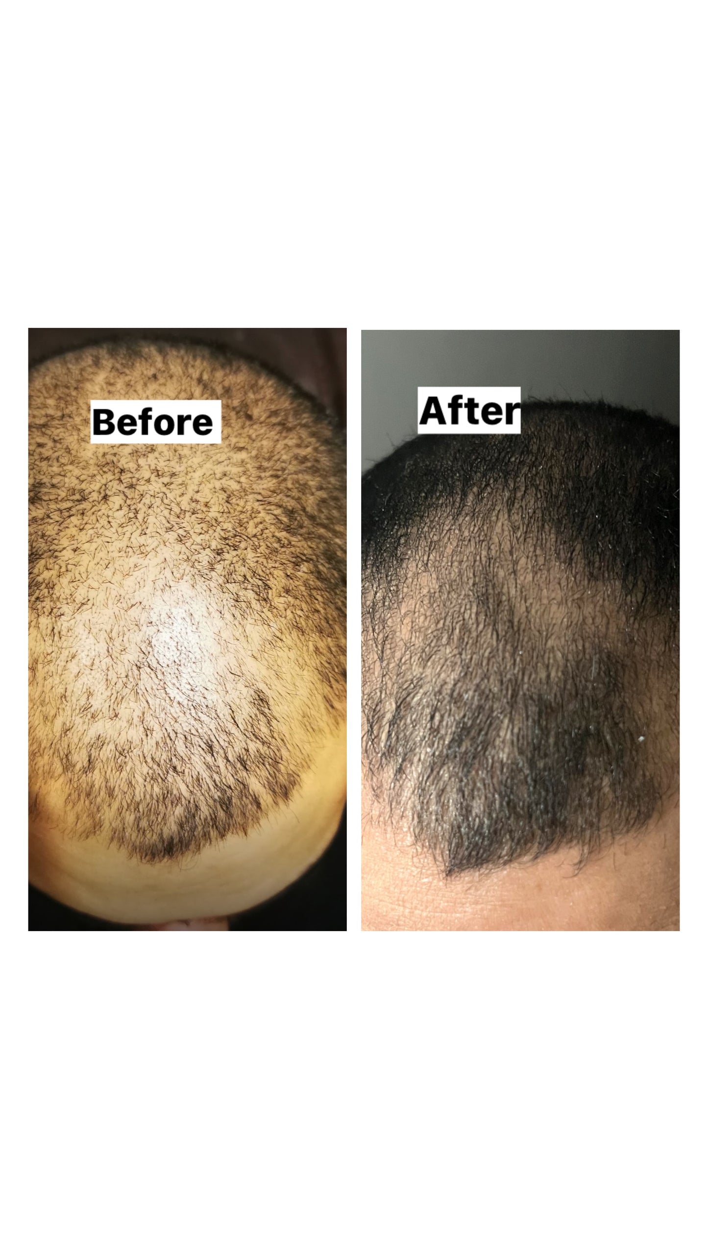 Hair Boost Concentrate Bundle